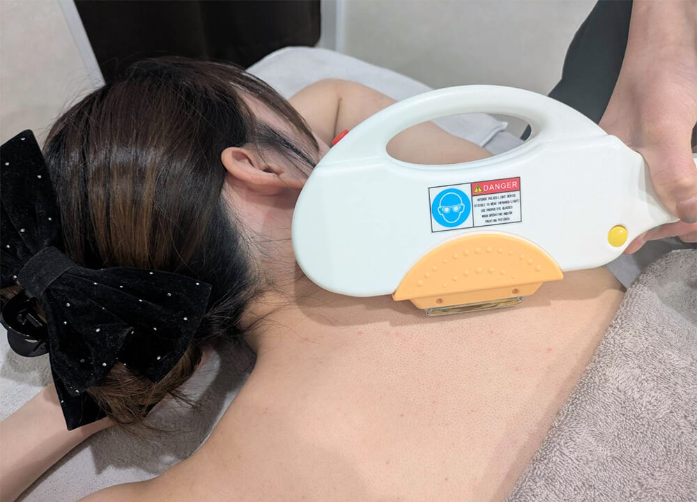 EPILATION